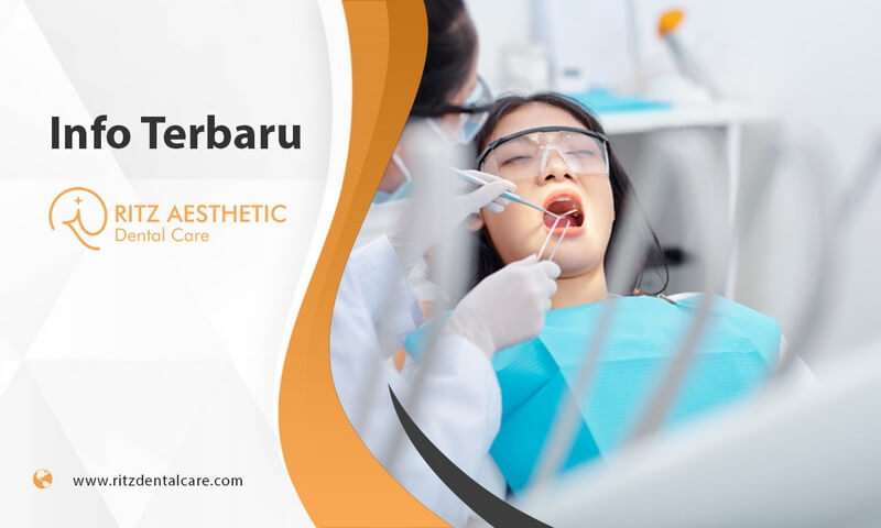 dokter gigi di lombok - Ritz Aesthetic Dental Care