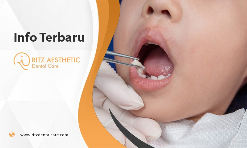 klinik dokter gigi di lombok - Ritz Aesthetic Dental Care