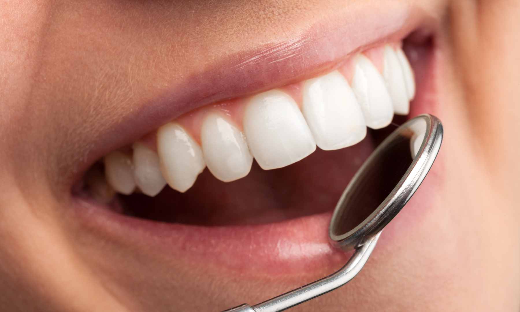 Seberapa Sering Harus ke Dokter Gigi? Cek Panduan Rutinnya